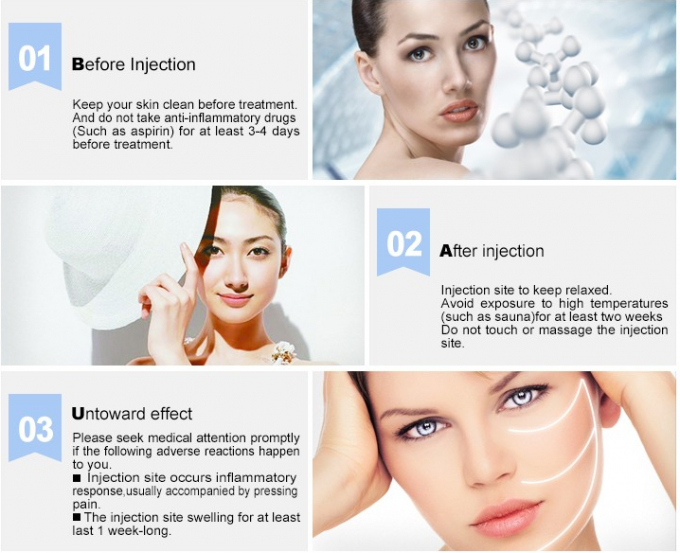 ISO에 의하여 증명되는 Hyaluronic 산 피부 충전물, 피부 충전물 훼이셜 아름다움 HA